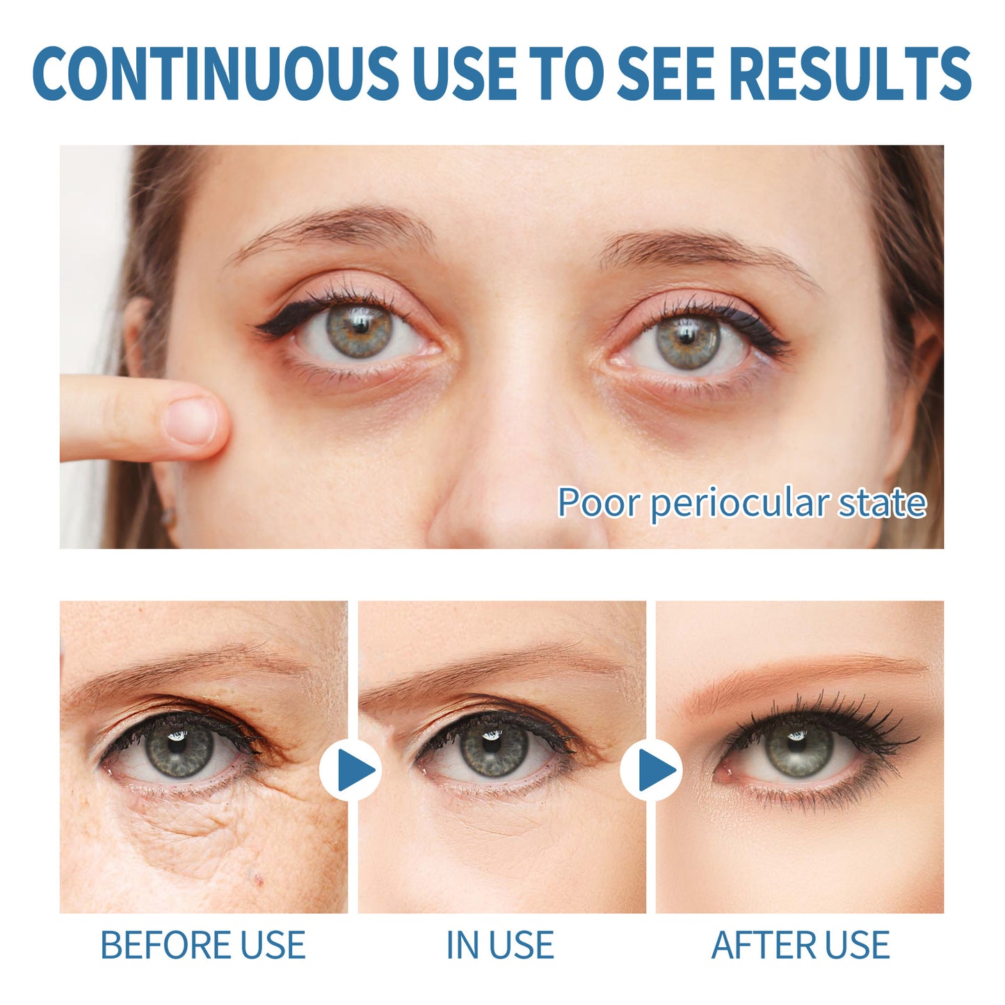 Patchs contour des yeux en gel, élastiques et hydratants pour la peau \ Eye Gel Patch Elastic Moisturizing Skin