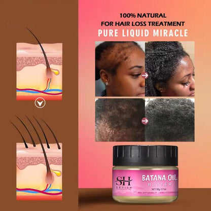 Antichute de cheveux Batana soins capillaires \ Batana hair loss treatment