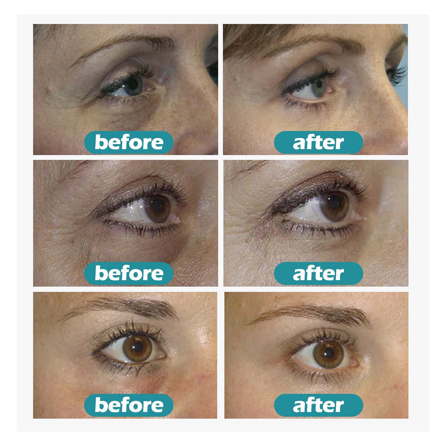 Fade Pattern Eye Care Gel Réparation Sac pour les yeux  \ Fade Eye Pattern Care Gel Repair Eye Bag