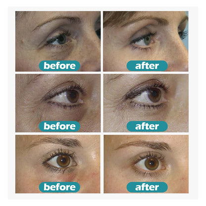 Fade Pattern Eye Care Gel Réparation Sac pour les yeux  \ Fade Eye Pattern Care Gel Repair Eye Bag